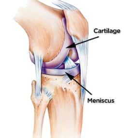 Knee Cartilage Tears, Knee Injuries
