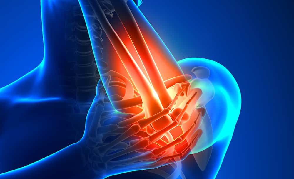 Elbow Pain, Tennis Elbow, Walkley Chiropractic Group, Bunbury Chiropractor, Chiropractor Bunbury